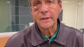 Alfredo Adame es operado de emergencia en el ojo tras golpiza que le propinaron