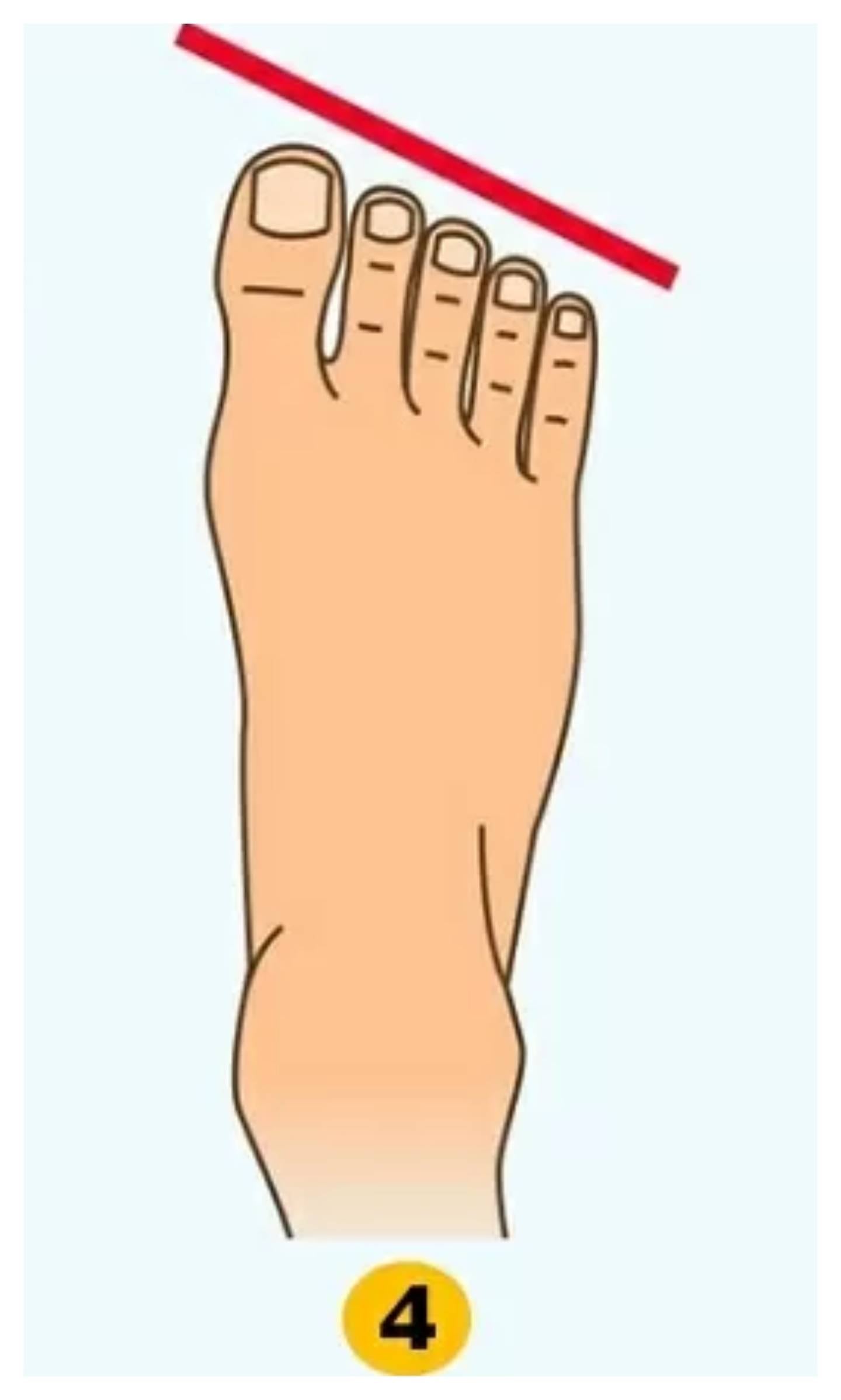 Ilustración de la forma de los pies.
