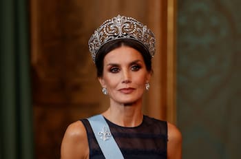 La reina Letizia recurre a implantes para esconder los efectos de una condición médica
