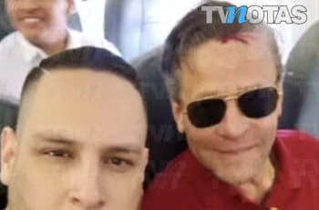 Alfredo Adame recibe paliza en la calle y azafata le presta auxilio durante un vuelo comercial
