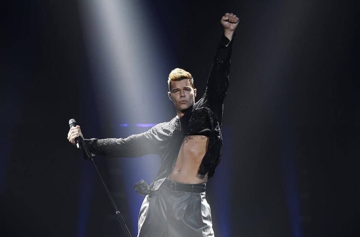 ¿No fue botox? Esta podría ser la razón del cambio en la cara de Ricky Martin