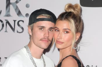 Hailey Bieber estuvo hospitalizada por tener síntomas de derrame cerebral