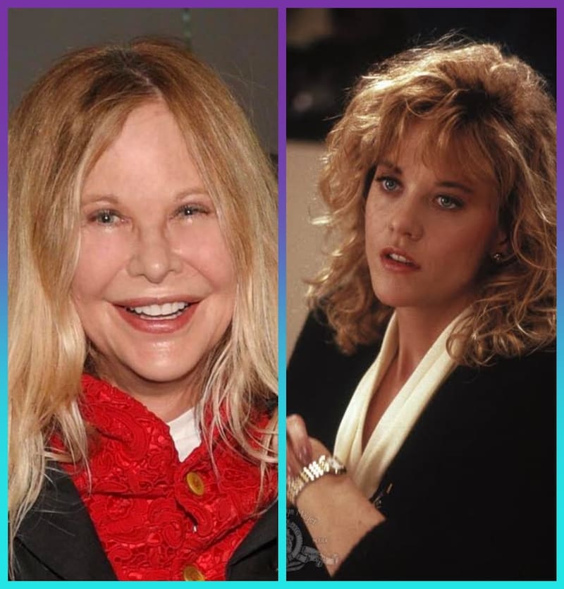 Meg soprendió por los cambios en su rostro que la hacen lucir irreconocible - Créditos: Instagram