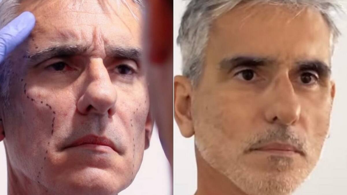 6 famosos que han pasado por el quirófano para lucir más bellos