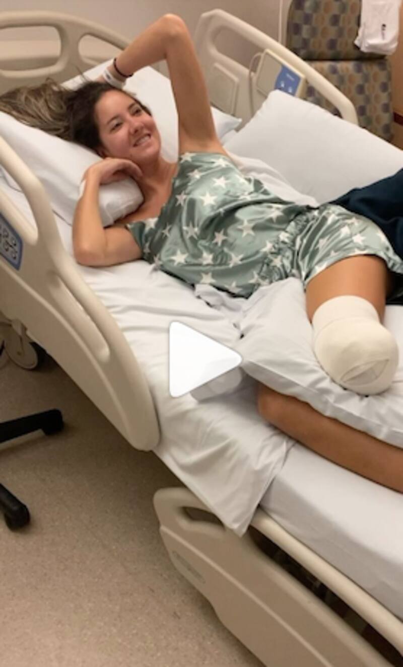 Daniella Álvarez publica emotivas palabras a dos años de la amputación de su pierna - Créditos: Instagram