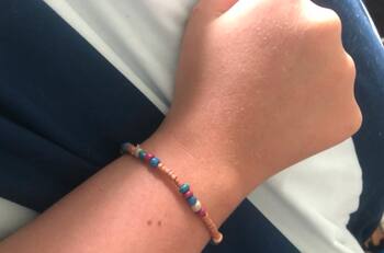 La extraña razón por la que todas las mujeres tienen el mismo lunar