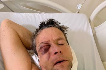 Pese a golpiza, Alfredo Adame asegura que él propinó varios golpes a sus agresores