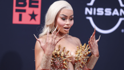 El drástico cambio de la cuñada de las Kardashians al quitarse los rellenos ¡Irreconocible!