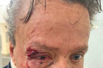 Alfredo Adame reaparece con complicado diagnóstico de salud tras golpiza