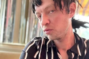 Hijo de Camilo Sesto reaparece con peluca y un desmejorado estado físico