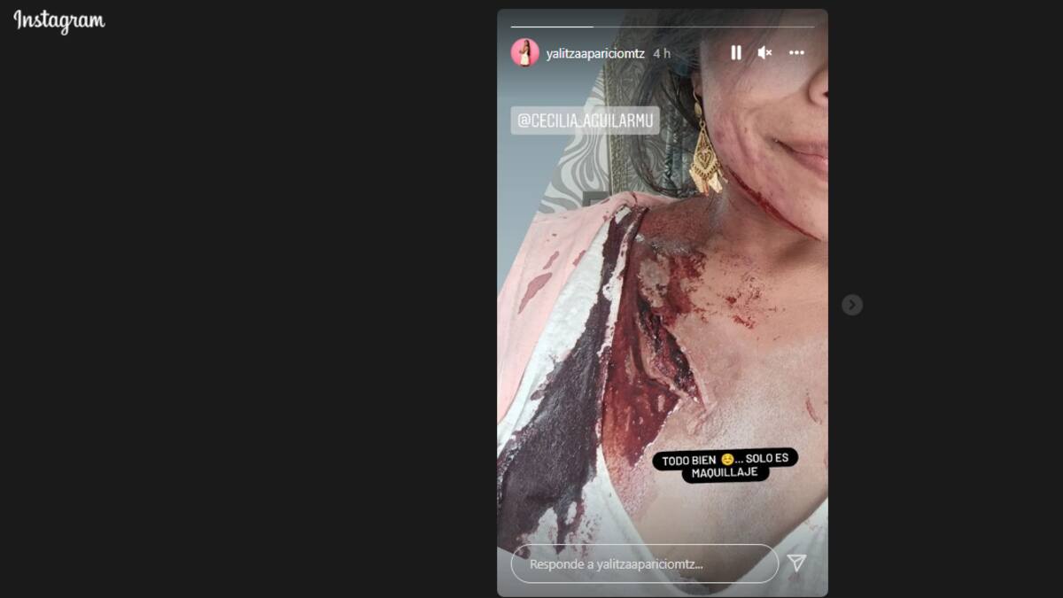 Yalitza Aparicio preocupa a sus seguidores tras mostrar una grave herida en su hombro
