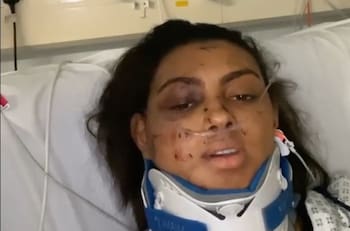 Reina de Gales se accidenta gravemente antes de asistir a Miss Mundo