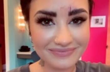 Demi Lovato sufre accidente que le deja grave herida en la frente
