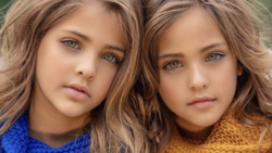 Así lucen a los 13 años Ava y Leah, "las gemelas más hermosas del mundo"
