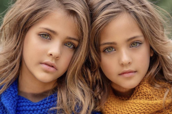 Así lucen a los 13 años Ava y Leah, "las gemelas más hermosas del mundo"