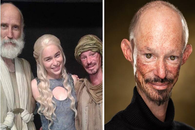 El actor fue diagnosticado con osteoporosis y artritis hace unos años.