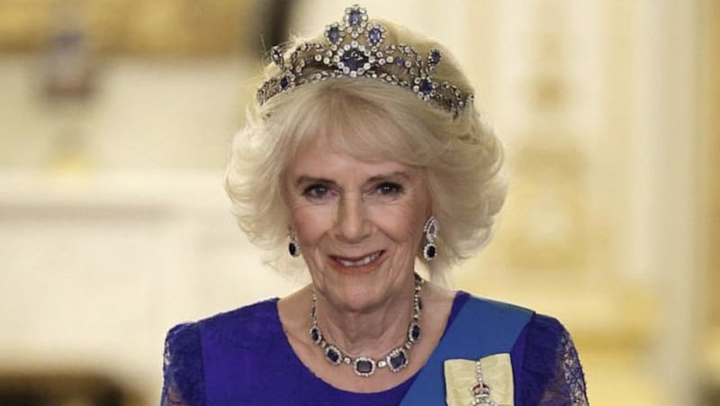 Las cirugías y procedimientos estéticos que se ha hecho la reina Camila - Créditos: Instagram