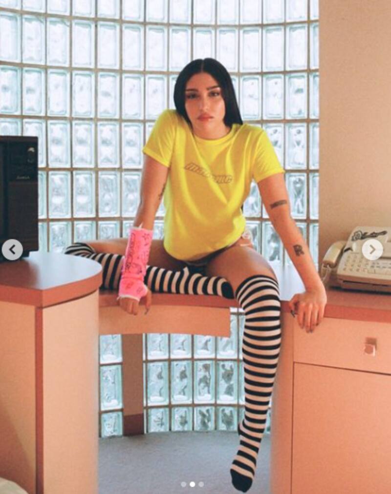 La hija de Madonna impresiona con escultural figura en polémica campaña con todo lesión en el brazo - Créditos: Instagram