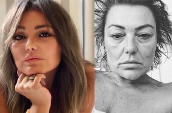 Ex cantante de La Oreja de Van Gogh deja en evidencia su mal estado