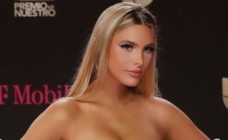 Lele Pons revela notable cambio de rostro tras cirugía estética - Créditos: Instagram