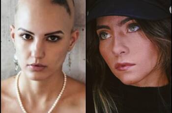 Hija de Raúl Araiza apoya a su novia para iniciar tratamiento contra la alopecia