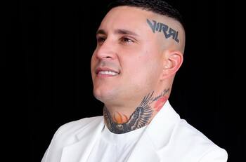 Osmani García se somete a doloroso tratamiento para quitarse los tatuajes de la cara