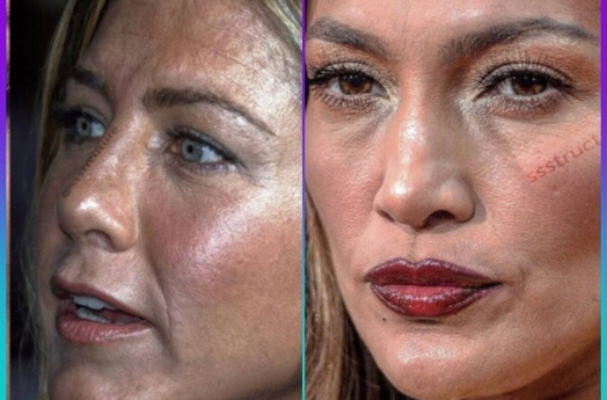 Famosas sin filtro y sin edición; así se le ve la piel en HD a las mujeres más guapas del mundo