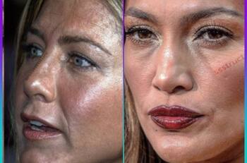 Famosas sin filtro y sin edición; así se le ve la piel en HD a las mujeres más guapas del mundo