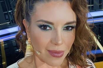 El doloroso proceso al que se sometió Alicia Machado para transformar su rostro