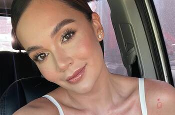 Lina Tejeiro muestra cómo le quedó la cara tras sufrir la mordida de un perro