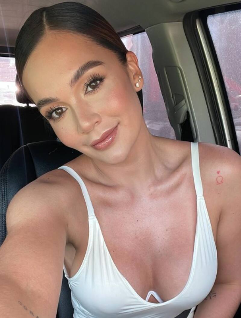 Lina Tejeiro muestra cómo le quedó la cara tras mordida de perro - Créditos: Instagram