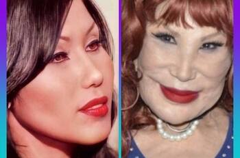 Las fotos de Lyn May antes y después de la cirugía estética que le arruinó la vida