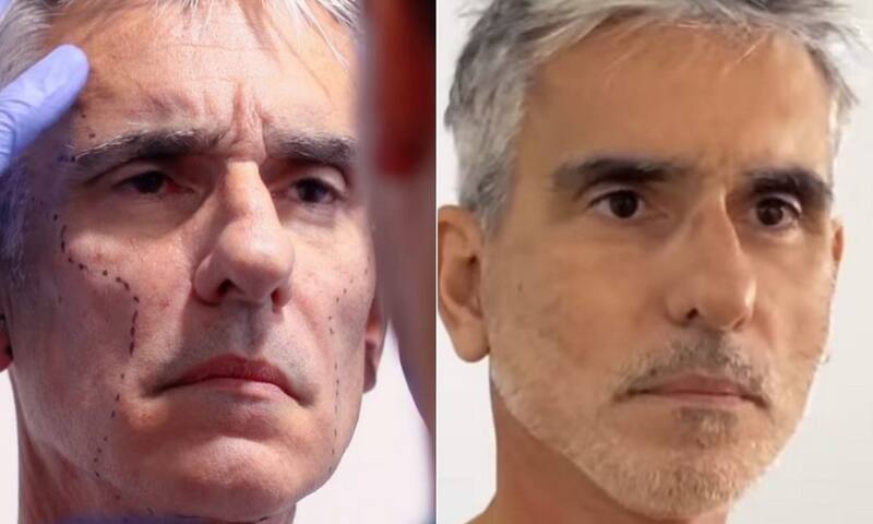 5 famosos que han pasado por el quirófano para lucir más bellos - Créditos: Instagram