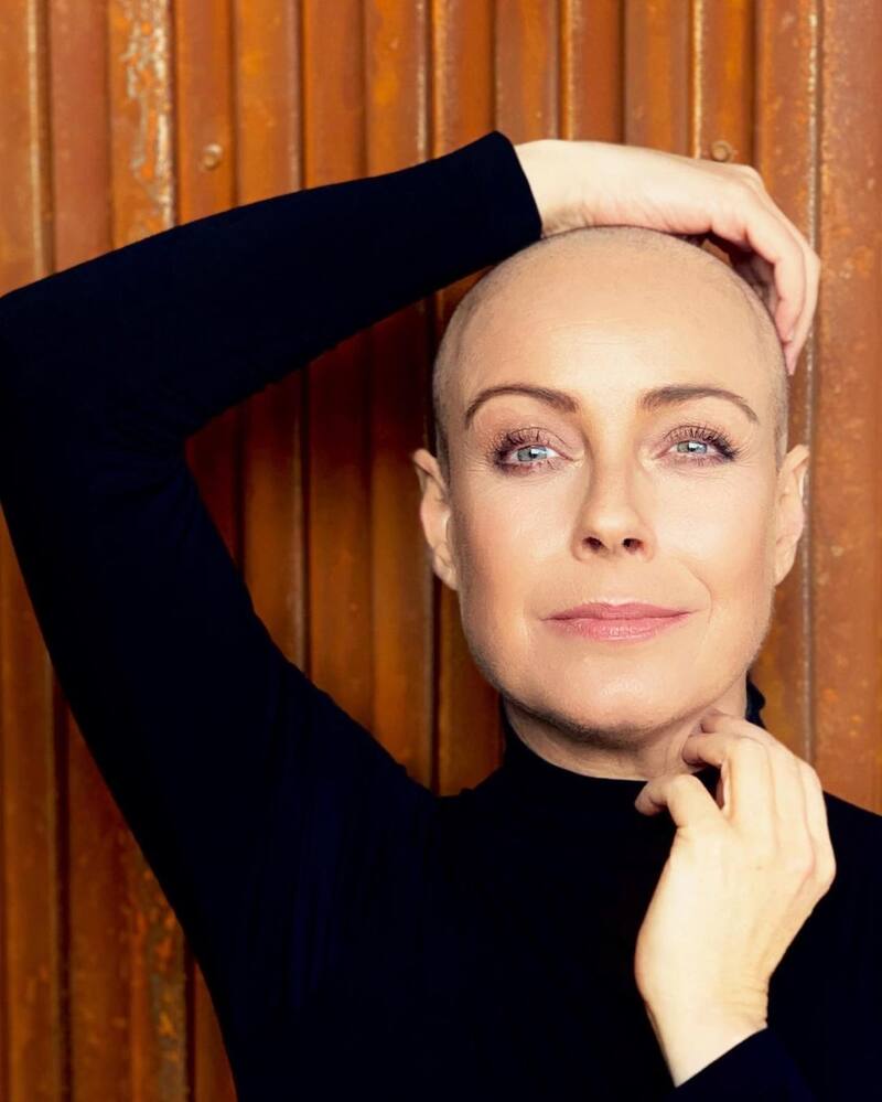 Claudia Conserva hace una importante reflexión sobre el cáncer de mama La presentador chilena se enteró en junio de su diagnóstico - Créditos: Instagram