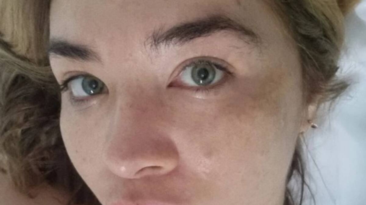 Daniela Luján reveló cuál es la enfermedad que padece a causa del estrés