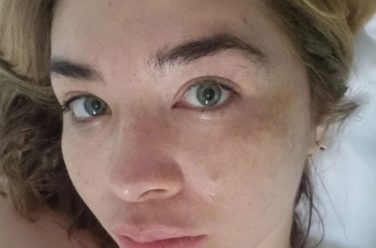 Daniela Luján reveló cuál es la enfermedad que padece a causa del estrés