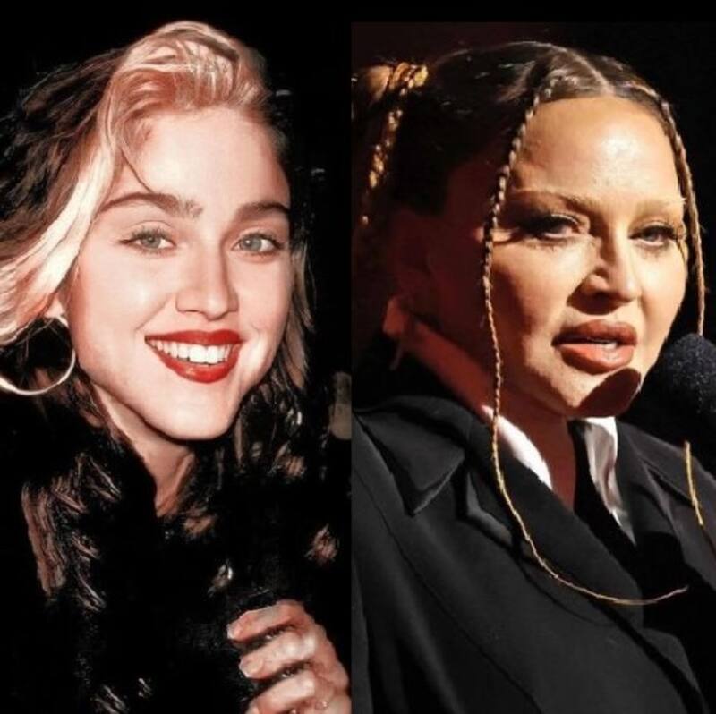 Madonna se mostró muy cambiada en los Grammys - Créditos: Twitter