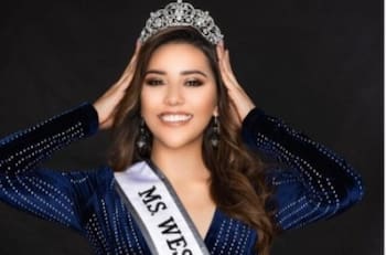 Ex reina de belleza lucha por segunda vez contra el cáncer; la quimioterapia no salvará su vida