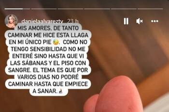 La herida que debe tratar Daniella Álvarez para que pueda volver a caminar