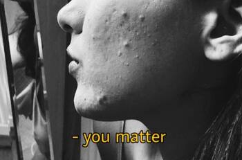 Actrices que están contra los estereotipos de belleza y apoyan el body positive