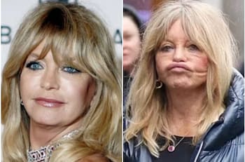 Goldie Hawn enciende las alarmas al lucir con el rostro desfigurado