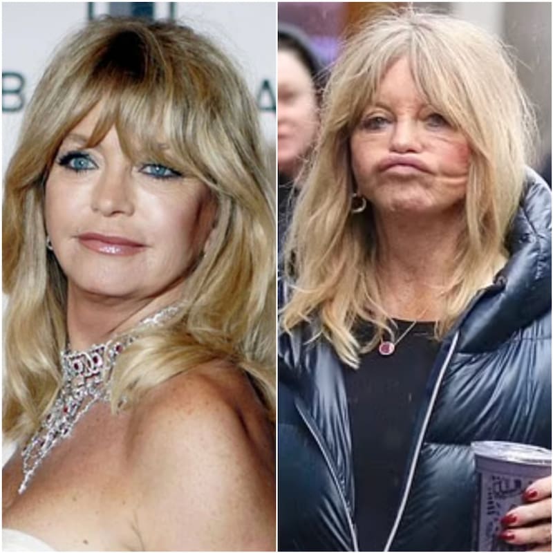 Goldie Hawn aparece con el rostro desfigurado - Créditos: Especial