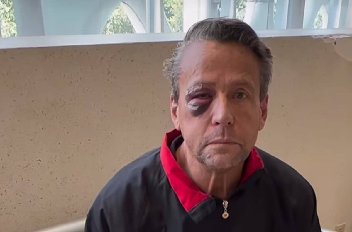 Video saca a la luz la verdad sobre la golpiza a Alfredo Adame