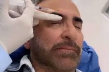 A este tratamiento estético se somete Vicente Fernández Jr., para verse más joven