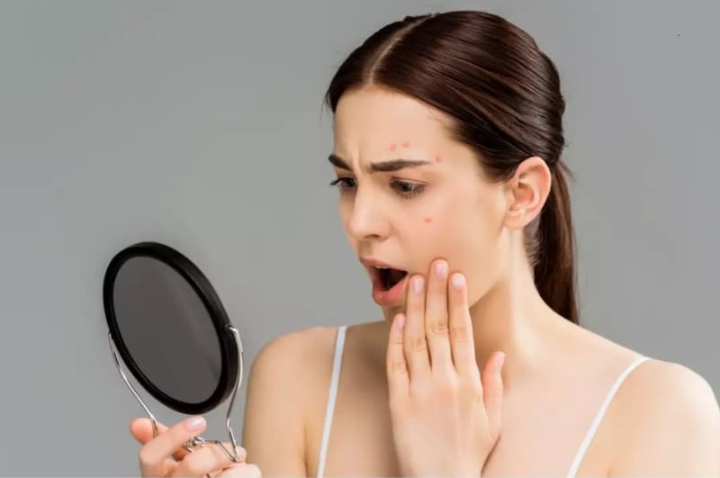 Usar toallas en el rostro puede causar desde problemas a la piel hasta infecciones estomacales