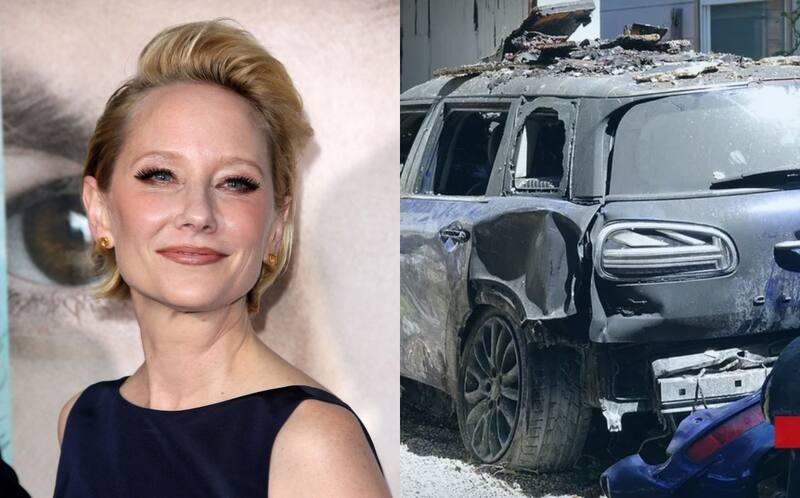 Anne Heche sufrió quemaduras y varias lesiones - Créditos: Instagram