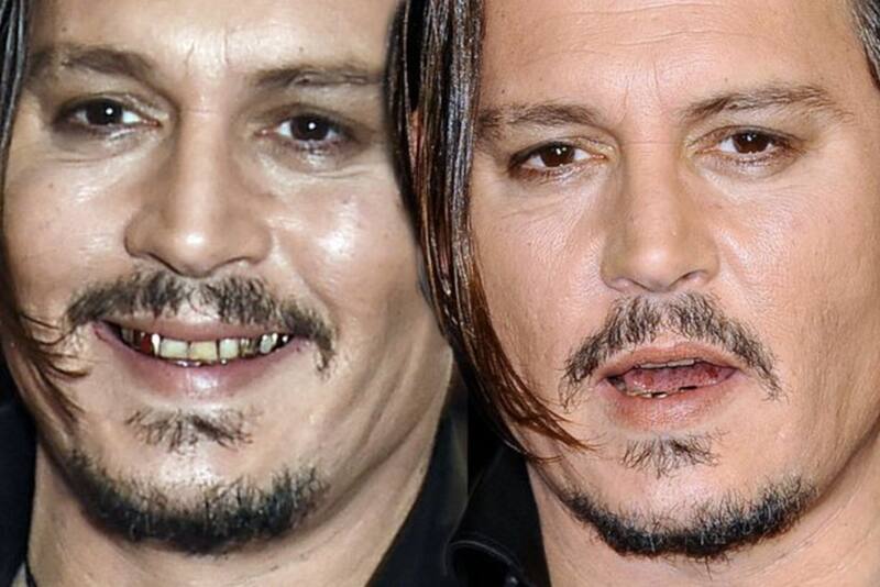 Johnny Depp causa polémica con sus dientes podridos - Créditos: Mirrror