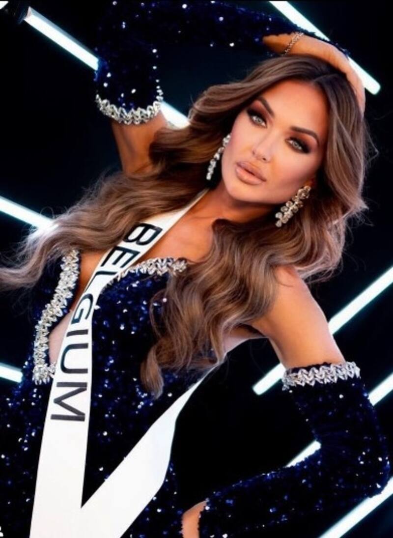 Reina de Miss Universo Bélgica sufre violento accidente automovilístico y queda en condición grave La reina de belleza tiene traumas en su cabeza y espalda - Créditos: Instagram
