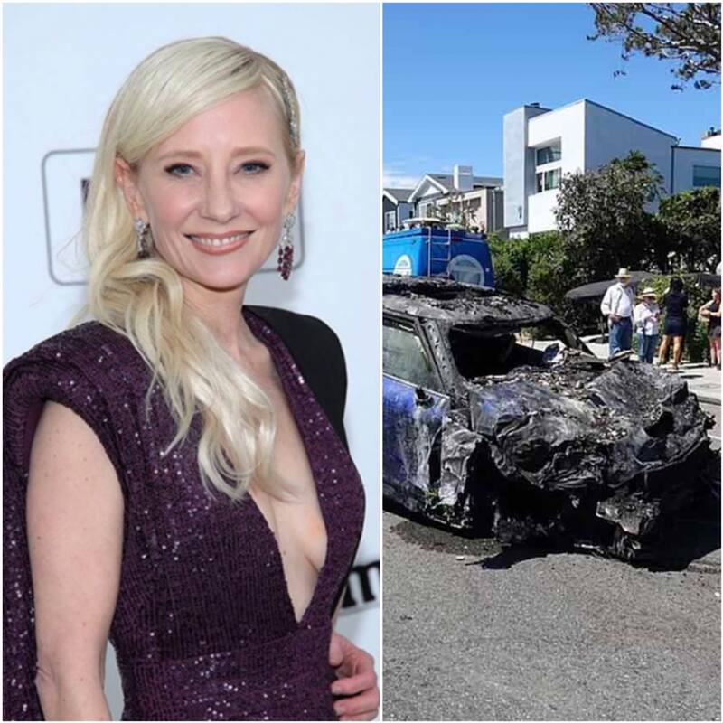 Actriz de 'Se lo que hicieron el verano pasado' sufre fuerte accidente y se encuentra grave - Créditos: Especial