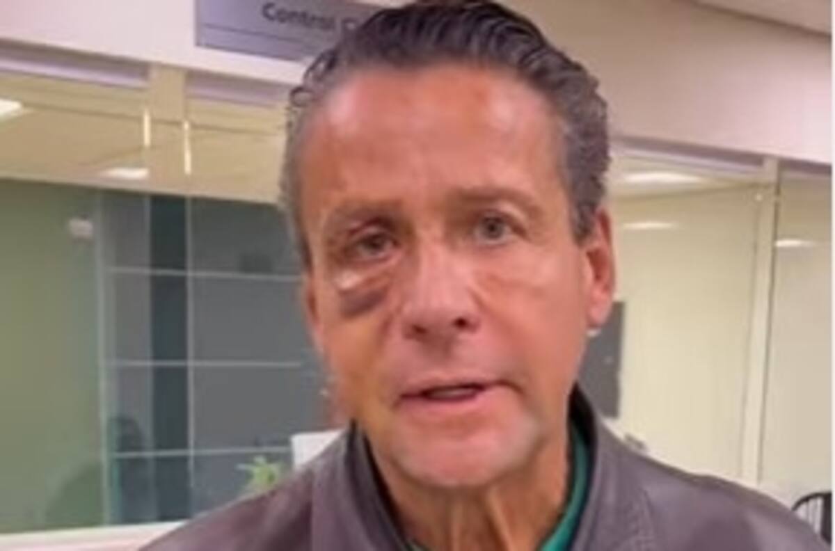 Alfredo Adame es operado de emergencia en el ojo tras golpiza que le propinaron